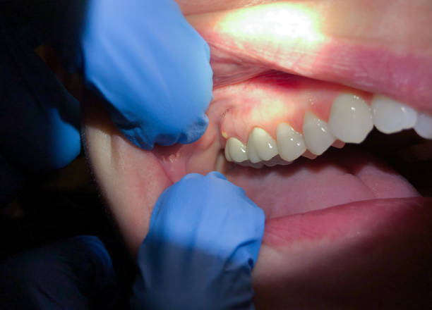 Best Broken Tooth Emergency  in Arnold, PA